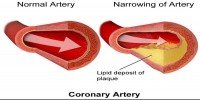 heart-artery-